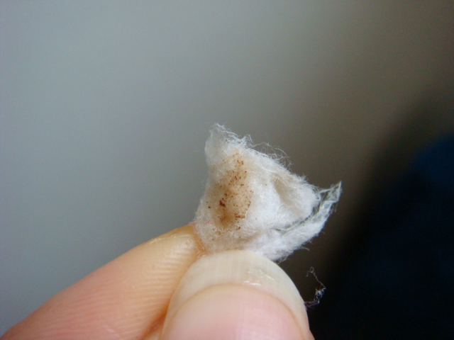 ПРОТЕРЛА ВЛАЖНОЙ ВАТОЙ